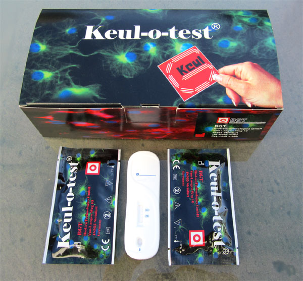 PSA K Schnelltestkassette für Vollblut-, Serum- oder Plasmaproben