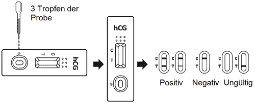 Durchführung und Auswertung des hCG-Kassettenschnelltests für Urinproben