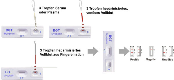 Durchfuehrung und Auswertung des Keul-o-tests Myoglobin