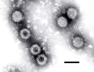 Mikroskopaufnahme von Rotaviren